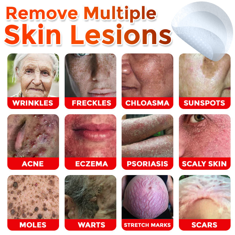 🌈SkinPrikyn™ MicroNeedle Botanic Skin Tag Removal Patch 🇺🇸 Made in the USA